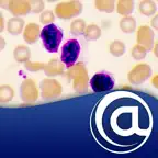 Chronic Lymphocytic Leukemia iOS Icon