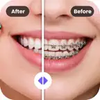 Braces AI Photo Editor iOS Icon