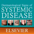 Derm Signs Systemic Disease 5E iOS Icon