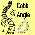 CobbAngleApp icon