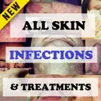 Skin Infections and Treatments iOS Icon