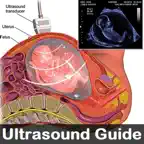 Ultrasound Guide Case Studies iOS Icon