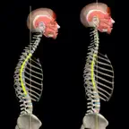 Muscle & Motion: Kyphosis iOS Icon