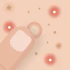 Blemish, Acne, Pimple remover iOS Icon