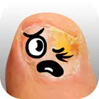 Find Nail Disease iOS Icon