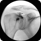 ArthroGuide icon