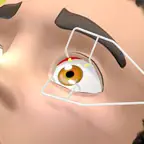 Eye Eye Doc iOS Icon