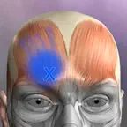 Muscle Trigger Points iOS Icon