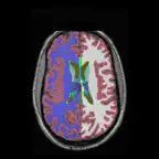 iSurf BrainView iOS Icon