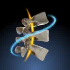 Spine Deformity iOS Icon