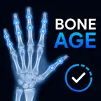 BoneAge:X-Ray Image assessment iOS Icon