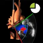 TEE Colour Doppler iOS Icon
