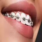 Orthodontic iOS Icon